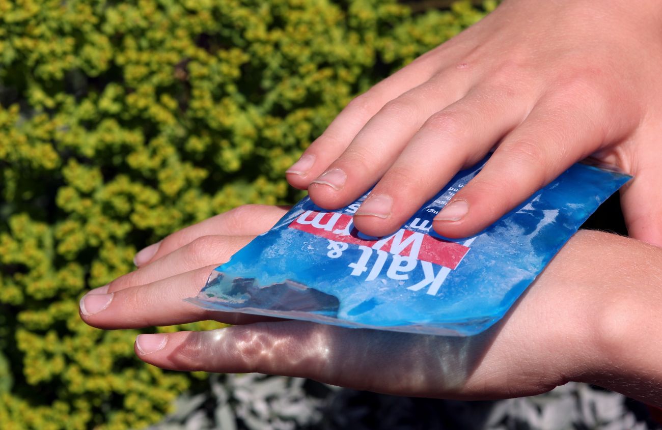 Bienenstich-Reaktion, eine Hand hält eine kalte Kompresse auf eine andere Hand