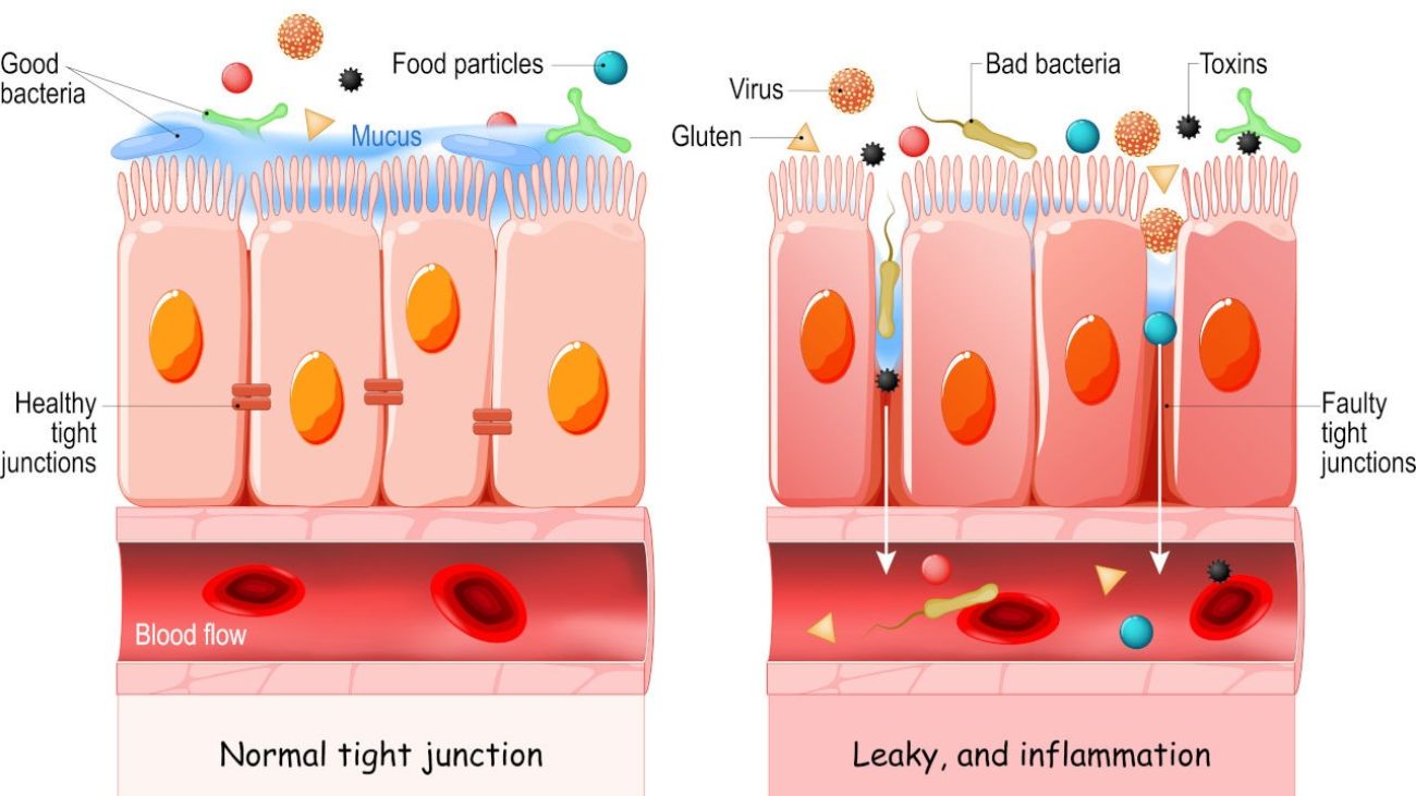 Ernährung bei Leaky-Gut-Syndrom, eine gesunde und eine durchlässige Darmwand